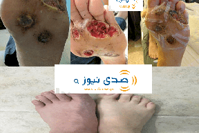     صور مروعة| خطير جدا ما اصاب هذا الرجل يمكن ان يصب أي احد فينا