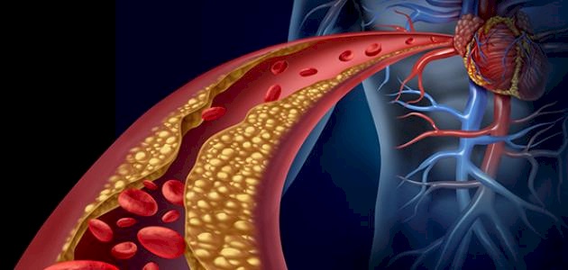 3 أمور تقتل الكوليسترول في الجسم