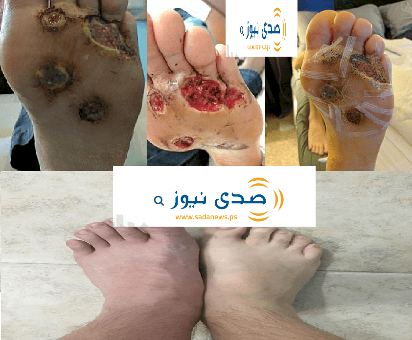     صور مروعة| خطير جدا ما اصاب هذا الرجل يمكن ان يصب أي احد فينا